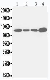 1 - Anti-Integrin Beta 3 Antibody ABO10941
