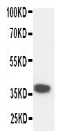1 - Anti-KLK5 Antibody ABO10944