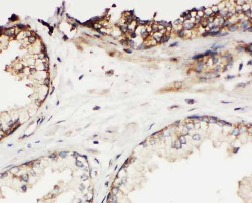 2 - Anti-KLK11 Antibody ABO10945