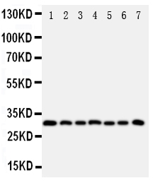 1 - Anti-KLK11 Antibody ABO10945