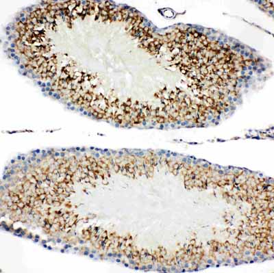 2 - Anti-KIM1 Antibody ABO10946