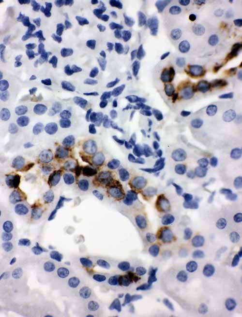 2 - Anti-KLK1 Antibody ABO10947