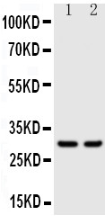 1 - Anti-KLK1 Antibody ABO10947