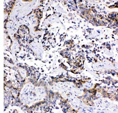 2 - Anti-MRP1 Antibody ABO10948
