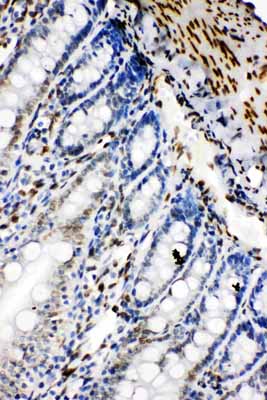 2 - Anti-Lamin B2 Antibody ABO10950