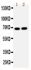 1 - Anti-Lamin B2 Antibody ABO10950