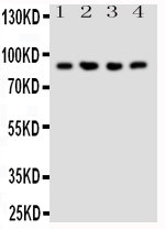 1 - Anti-NRG2 Antibody ABO10951