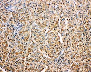 2 - Anti-Kallistatin/Serpina4 Antibody ABO10952