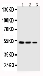 1 - Anti-Kallistatin/Serpina4 Antibody ABO10952