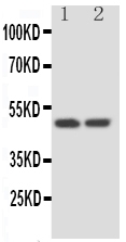 1 - Anti-Kallistatin/Serpina4 Antibody ABO10952