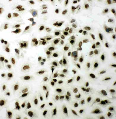 8 - Anti-XRCC1 Antibody ABO10953