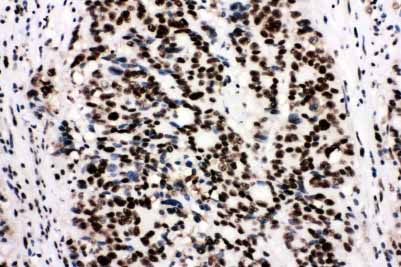 2 - Anti-Ku80 Antibody ABO10955