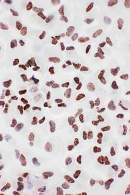 8 - Anti-Ku70 Antibody ABO10957