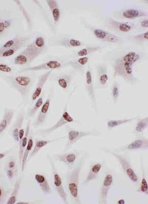8 - Anti-Ku70 Antibody ABO10957