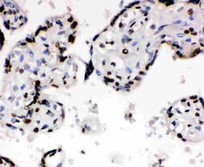 2 - Anti-Ku70 Antibody ABO10957