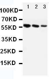 1 - Anti-Angiotensinogen Antibody ABO10958