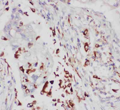 2 - Anti-ALOX5 Antibody ABO10959