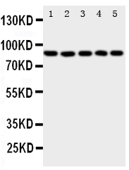 1 - Anti-ALOX5 Antibody ABO10959