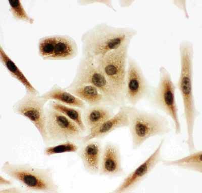 8 - Anti-Bub3 Antibody ABO10960