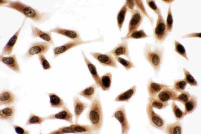 8 - Anti-Bub3 Antibody ABO10960
