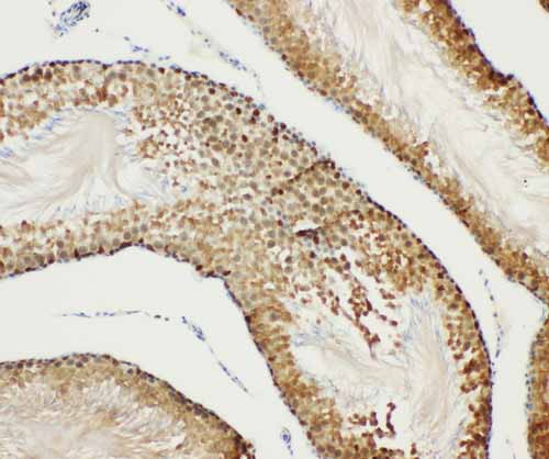 2 - Anti-Bub3 Antibody ABO10960