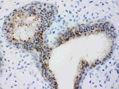 2 - Anti-Bub3 Antibody ABO10960