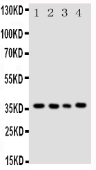 1 - Anti-Bub3 Antibody ABO10960