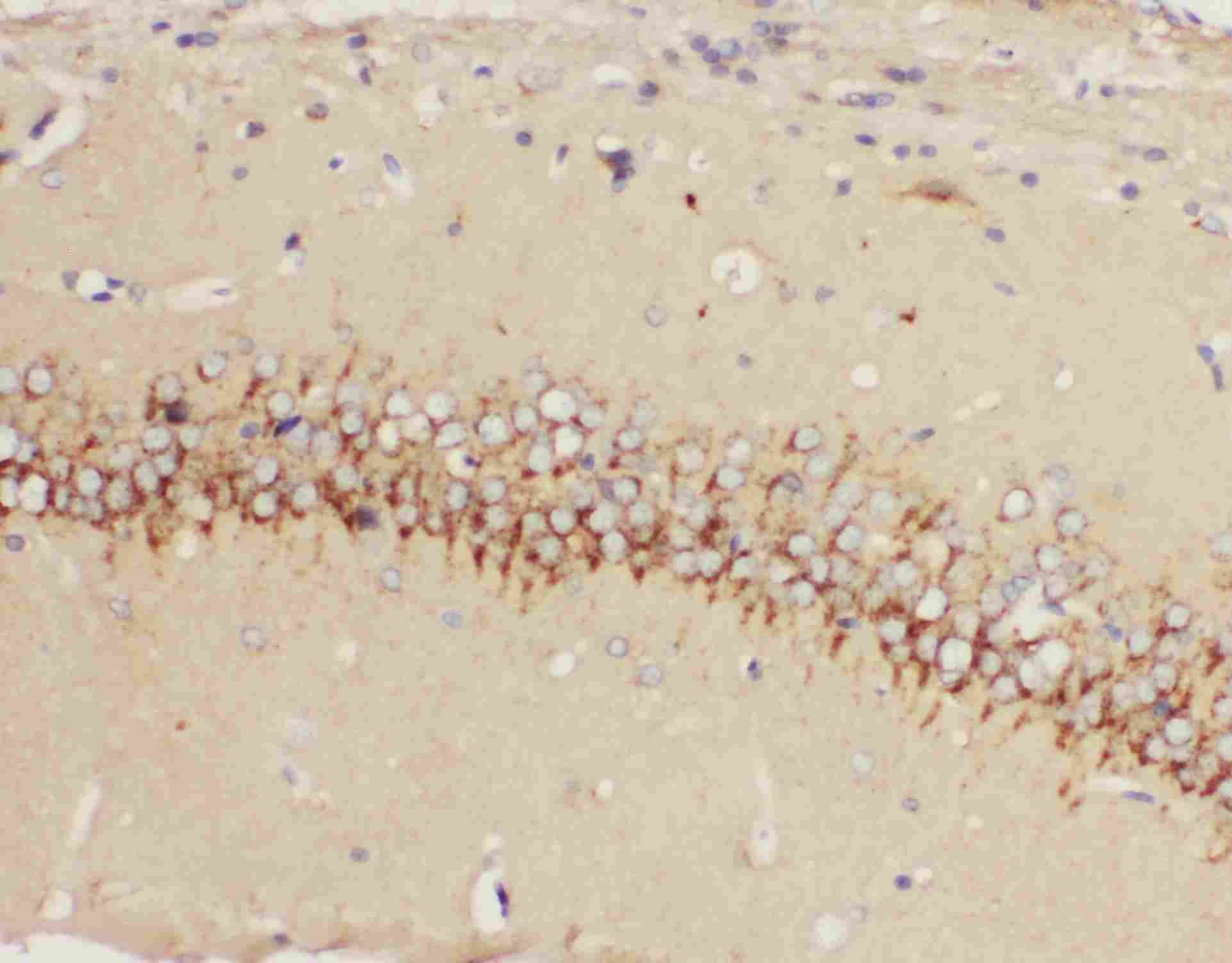 2 - Anti-5HT1A Receptor Antibody ABO10962