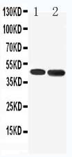 1 - Anti-5HT1A Receptor Antibody ABO10962