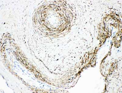 2 - Anti-MAOA Antibody ABO10963