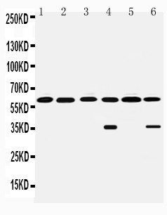 1 - Anti-MAOB Antibody ABO10964