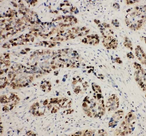 2 - Anti-MCM2 Antibody ABO10965