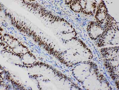 2 - Anti-MCM2 Antibody ABO10965