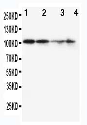 1 - Anti-MCM2 Antibody ABO10965