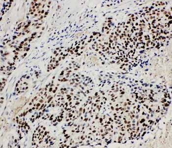 2 - Anti-MCM3 Antibody ABO10966