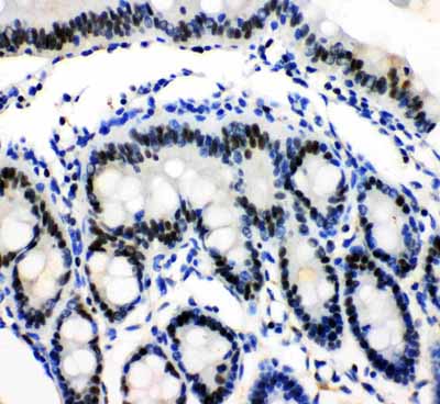 2 - Anti-MCM3 Antibody ABO10966