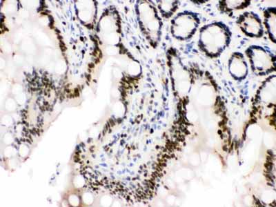 2 - Anti-MCM3 Antibody ABO10966