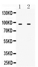 1 - Anti-MCM3 Antibody ABO10966