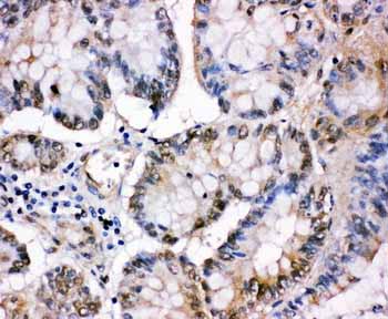 2 - Anti-MCM5 Antibody ABO10968