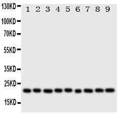 1 - Anti-Cytoglobin Antibody ABO10972