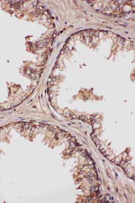 2 - Anti-LCN1 Antibody ABO10974