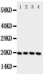 1 - Anti-LCN1 Antibody ABO10974