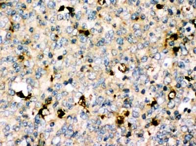 2 - Anti-MyD88 Antibody ABO10975