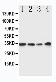 1 - Anti-MyD88 Antibody ABO10975