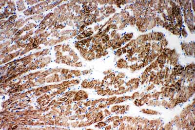 2 - Anti-NDUFA1 Antibody ABO10976