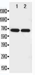 1 - Anti-Netrin 1 Antibody ABO10977