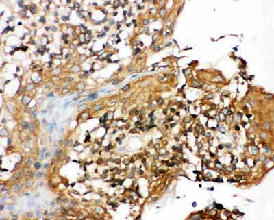 2 - Anti-CIAS1/NALP3 Antibody ABO10980