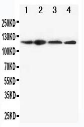 1 - Anti-CIAS1/NALP3 Antibody ABO10980