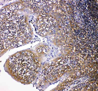 2 - Anti-NOX2/gp91phox Antibody ABO10982