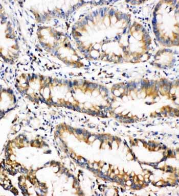 2 - Anti-OSM/Oncostatin M Antibody ABO10983